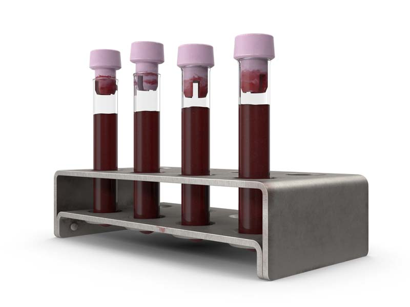 طرح گرافیکی از چهار عدد لوله آزمایش خون